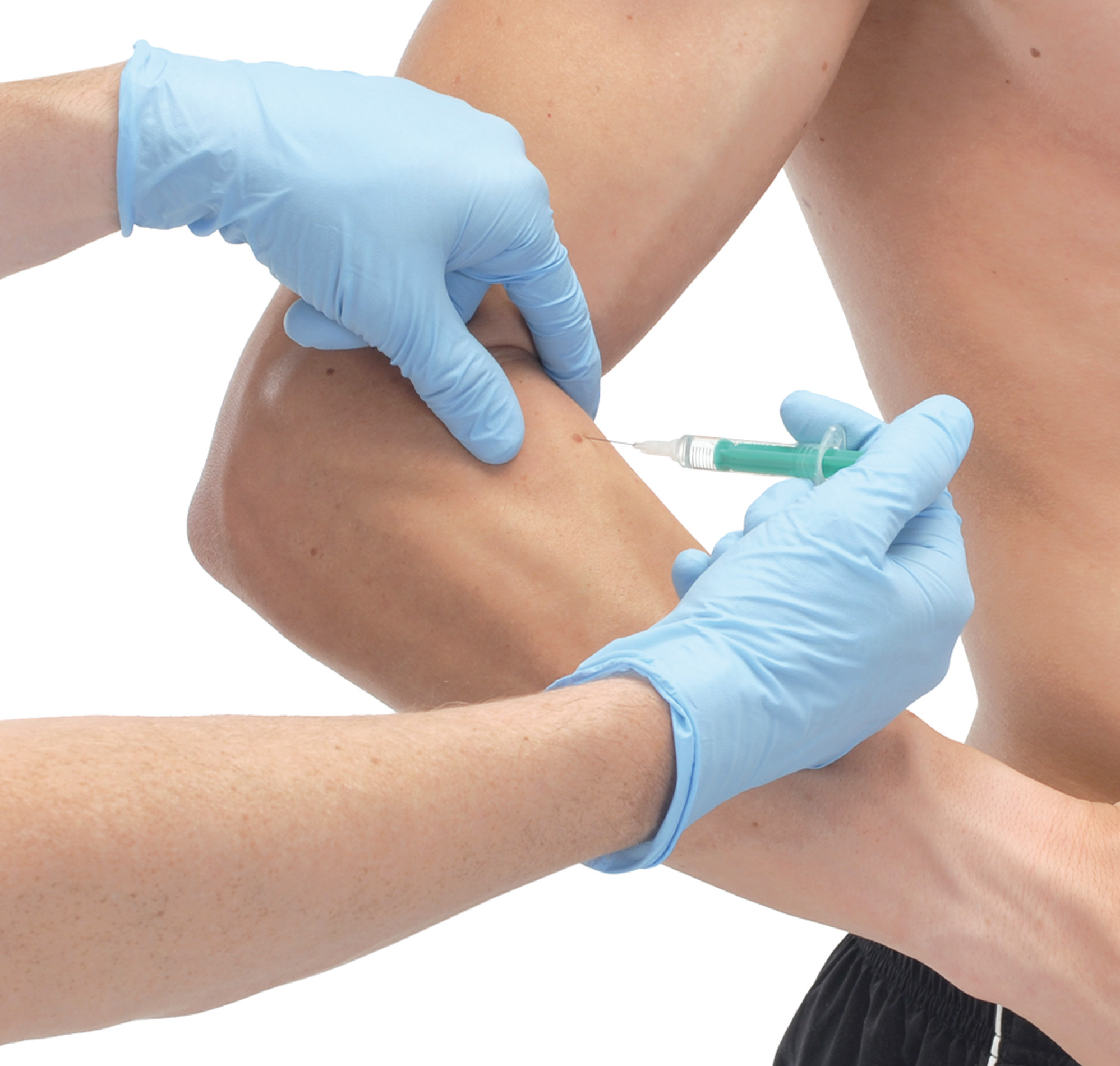 Ambulantno zdravljenje žariščne spastičnosti s toksinom botulina po novem odobreno za vse bolnike z okvaro centralnega živčnega sistema